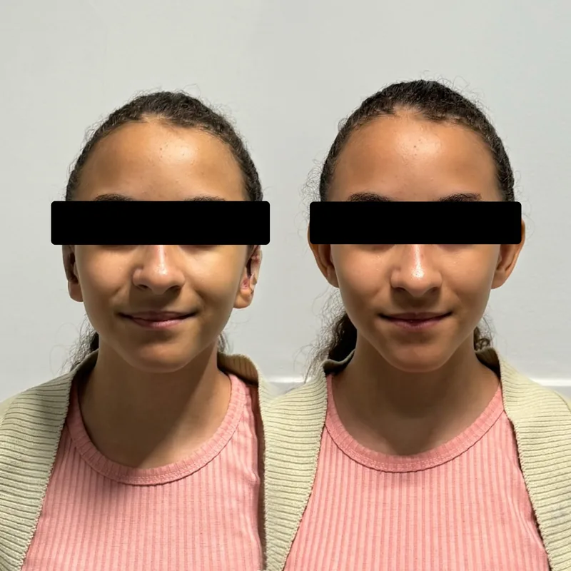 Antes y después de un tratamiento en Salinova