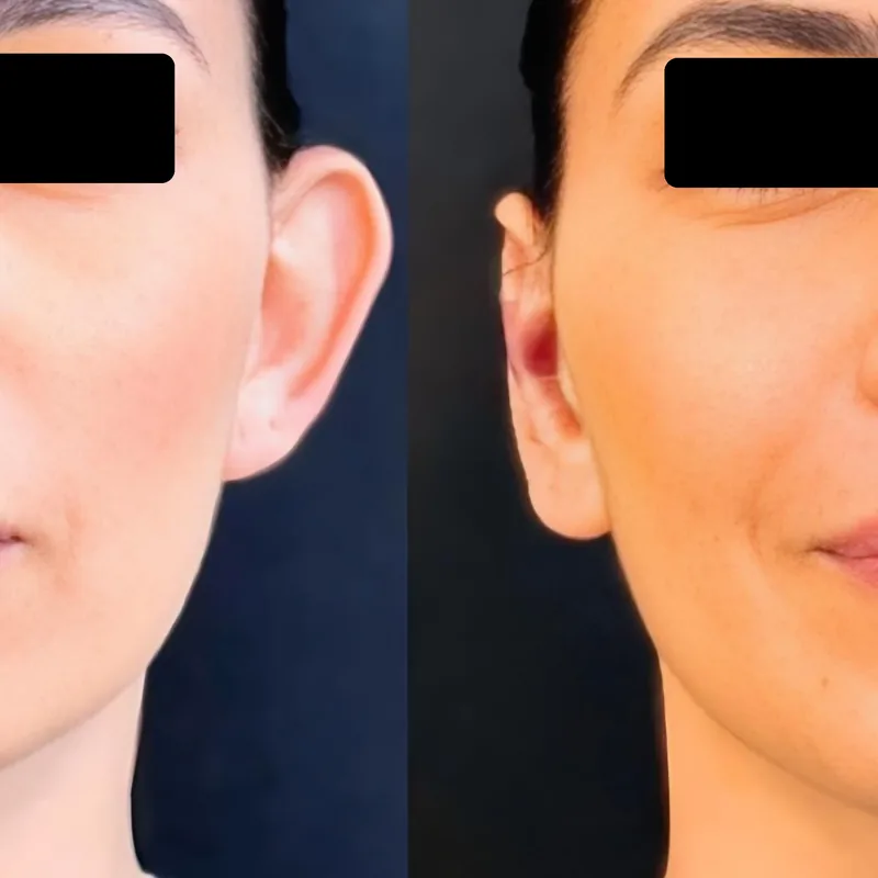 Antes y después de un tratamiento en Salinova